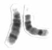 Imagen del cromosoma 14 en microscopio.