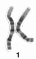 Cromosoma 1