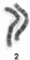 Cromosoma 2