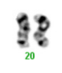 Cromosoma 20 en microscopio.